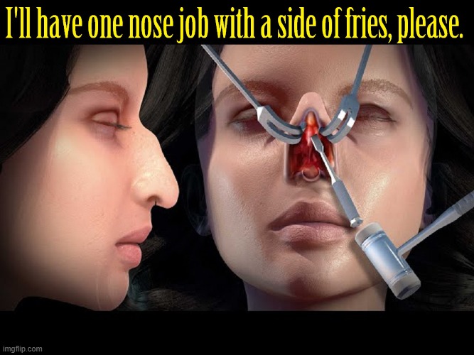 Sticking your Nose Where it Doesn't Belong | image tagged in vince vance,rhinoplasty,big nose,nose,job,cursed image | made w/ Imgflip meme maker