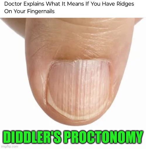 Funny | DIDDLER'S PROCTONOMY | image tagged in funny,diddy,proctologist,testing,funny kids test answers,tests | made w/ Imgflip meme maker