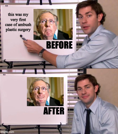 Jim Halpert Explains | this was my very first case of ambush plastic surgery BEFORE AFTER | image tagged in jim halpert explains | made w/ Imgflip meme maker