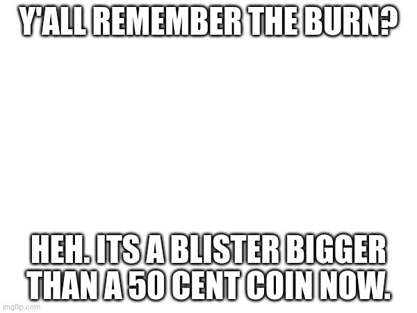 I'm in pain | Y'ALL REMEMBER THE BURN? HEH. ITS A BLISTER BIGGER THAN A 50 CENT COIN NOW. | image tagged in burn | made w/ Imgflip meme maker