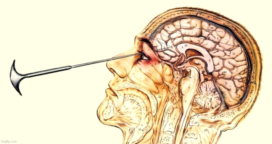 lobotomy time | image tagged in lobotomites beware | made w/ Imgflip meme maker