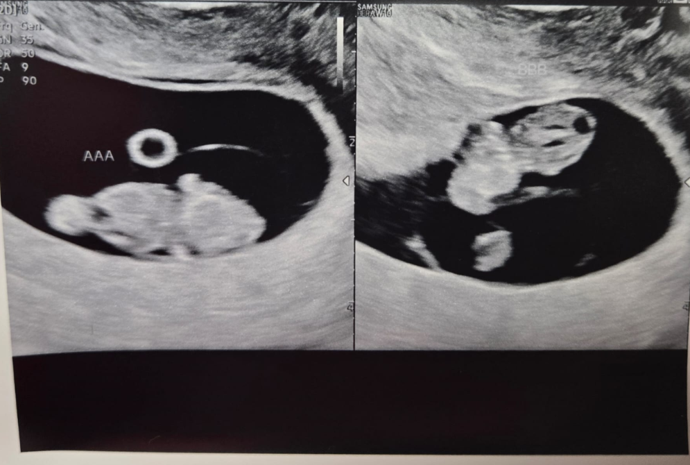 Baby Blank Meme Template