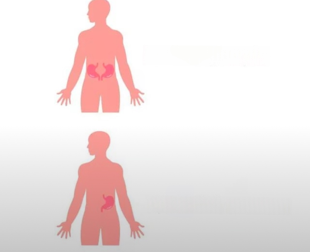 Sold Kidney Blank Meme Template