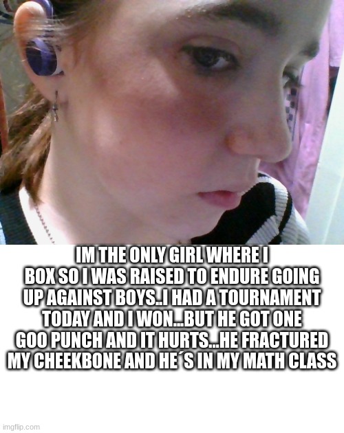 help meee | IM THE ONLY GIRL WHERE I BOX SO I WAS RAISED TO ENDURE GOING UP AGAINST BOYS..I HAD A TOURNAMENT TODAY AND I WON...BUT HE GOT ONE GOO PUNCH AND IT HURTS...HE FRACTURED MY CHEEKBONE AND HE´S IN MY MATH CLASS | image tagged in bruised,boxing | made w/ Imgflip meme maker