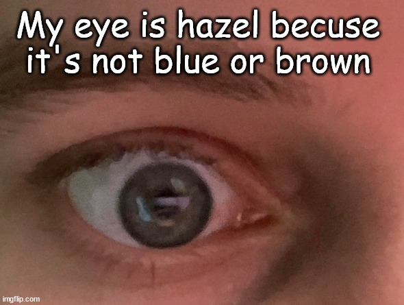 Hazel random | My eye is hazel becuse it's not blue or brown | image tagged in hazel | made w/ Imgflip meme maker