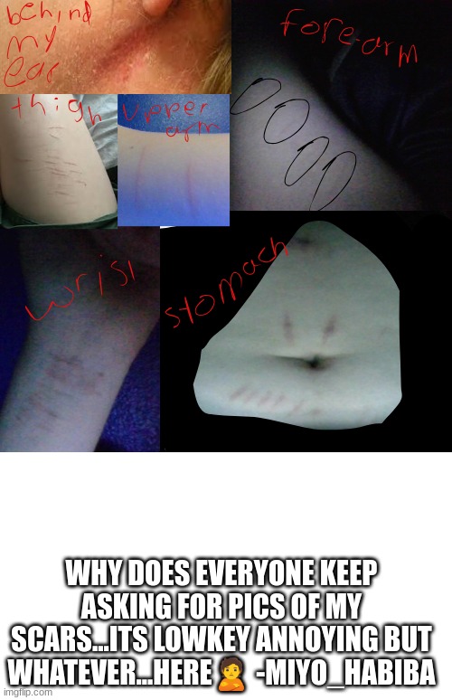 plz dont report me/hate me...i have a lot going on and i was being stupid... | WHY DOES EVERYONE KEEP ASKING FOR PICS OF MY SCARS...ITS LOWKEY ANNOYING BUT WHATEVER...HERE🙎 -MIYO_HABIBA | image tagged in its so embarassing | made w/ Imgflip meme maker