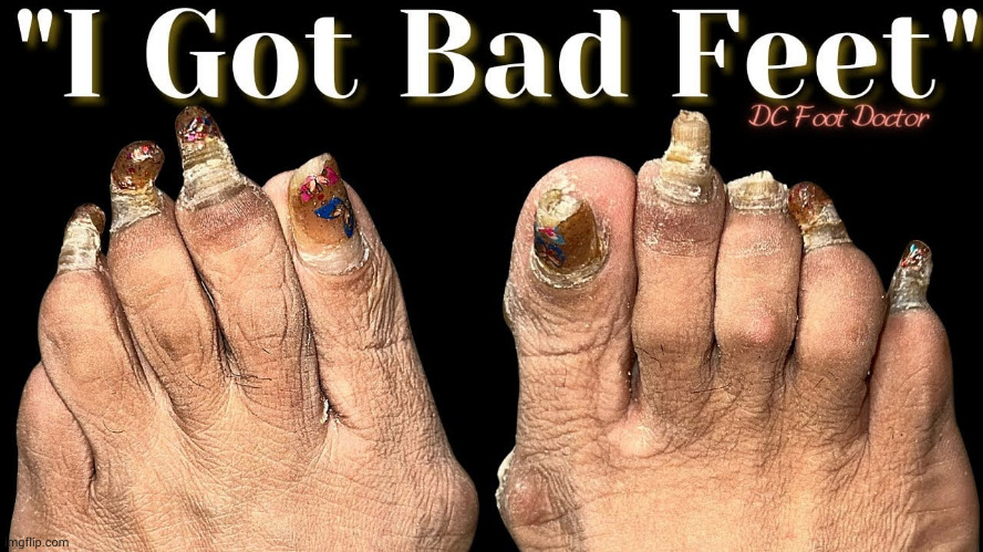 is it normal that my feet look like this. | made w/ Imgflip meme maker