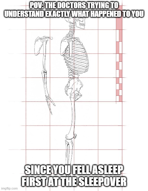 medical diagram meme | POV: THE DOCTORS TRYING TO UNDERSTAND EXACTLY WHAT HAPPENED TO YOU; SINCE YOU FELL ASLEEP FIRST AT THE SLEEPOVER | image tagged in skeleton,waiting skeleton,sleepover,they had us in the first half | made w/ Imgflip meme maker