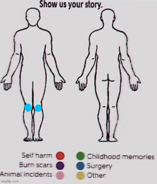 grinch knee surgery meme is still MASSIVE dude | made w/ Imgflip meme maker