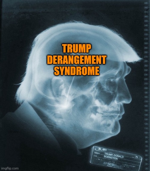 trump's brain | TRUMP DERANGEMENT SYNDROME | image tagged in trump's brain | made w/ Imgflip meme maker