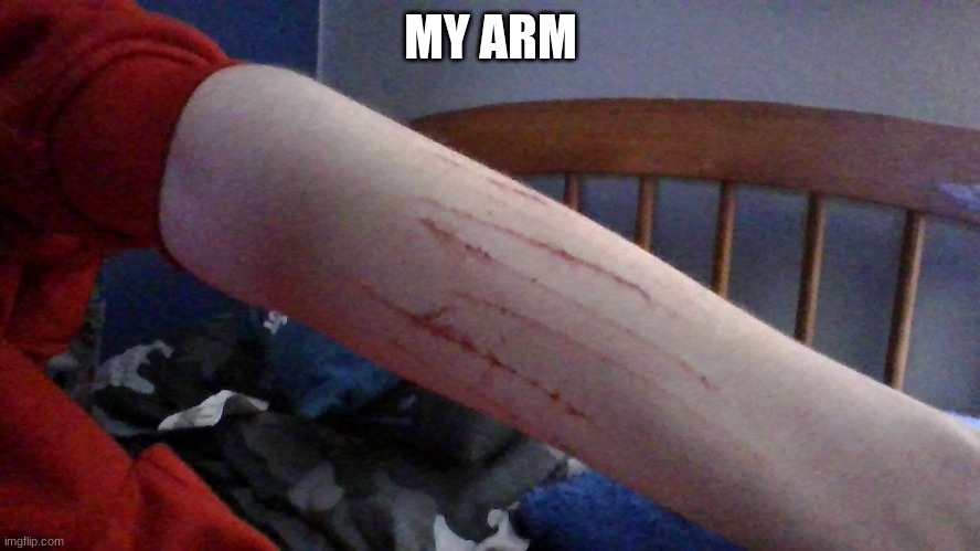 my arm. not done cutting yet tho. | MY ARM | made w/ Imgflip meme maker