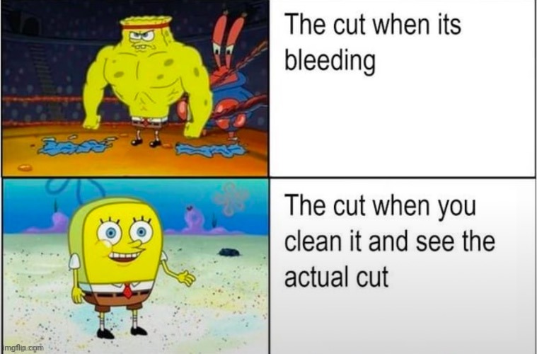 The cut | image tagged in cut,cuts,repost,reposts,memes,bleeding | made w/ Imgflip meme maker