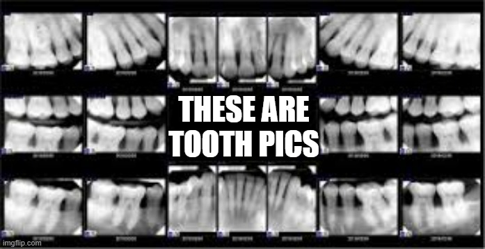 memes by Brad - Did someone ask for some "tooth pics?"  - humor - | THESE ARE TOOTH PICS | image tagged in funny,fun,play on words,teeth,humor,dentist | made w/ Imgflip meme maker