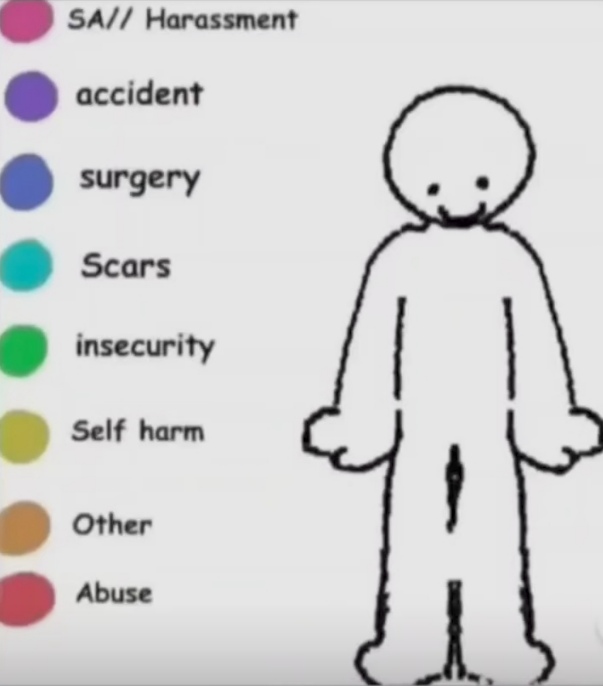 Where is your pain? Blank Meme Template
