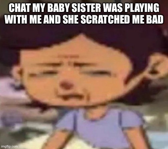 she thought she was tickling me and it hurts | CHAT MY BABY SISTER WAS PLAYING WITH ME AND SHE SCRATCHED ME BAD | image tagged in luz distressed | made w/ Imgflip meme maker