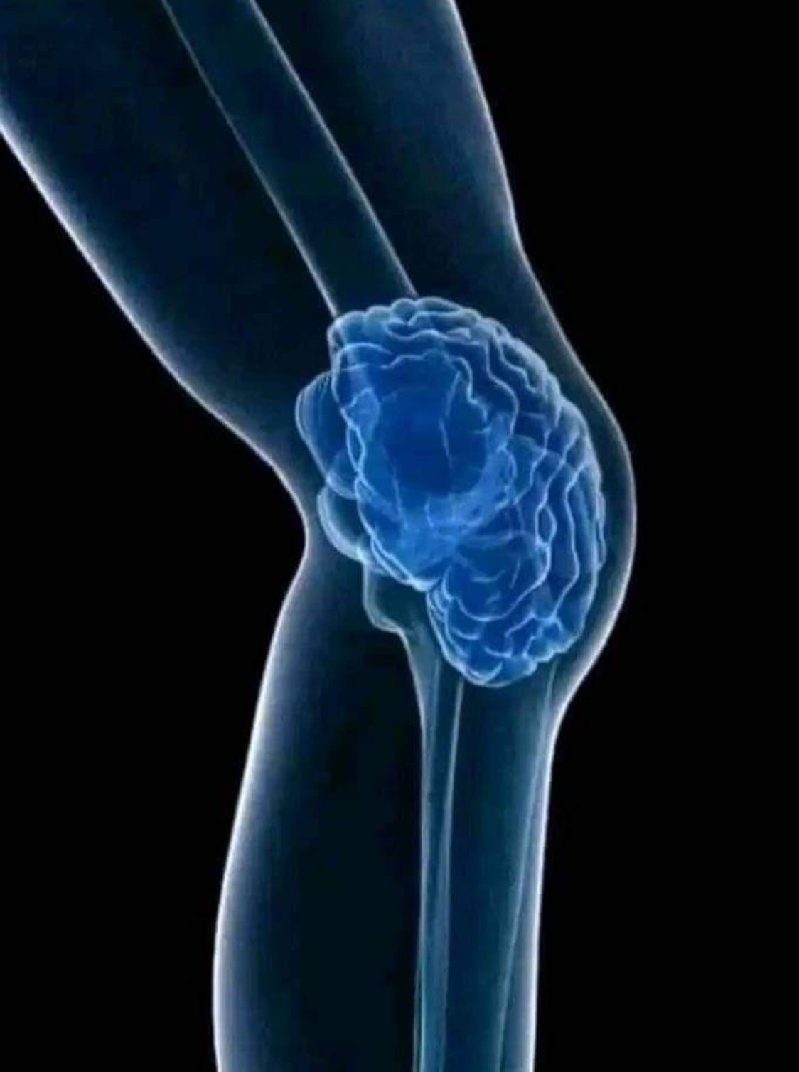 knee brain Blank Meme Template