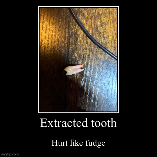 Extracted tooth | Hurt like fudge | image tagged in funny,demotivationals,tooth | made w/ Imgflip demotivational maker