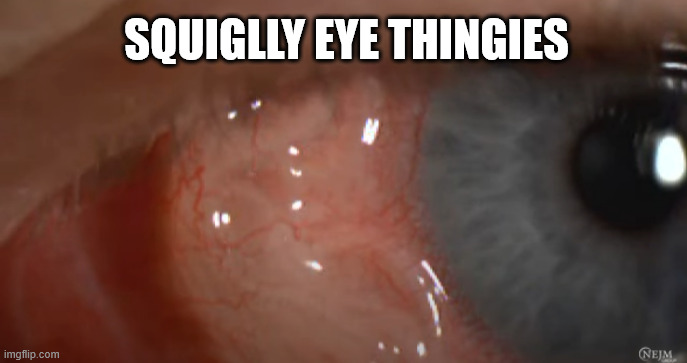 SQUIGLLY EYE THINGIES | image tagged in yes | made w/ Imgflip meme maker