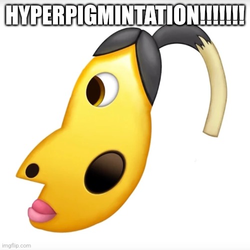 is that hyperpigmentation? | HYPERPIGMINTATION!!!!!!! | image tagged in is that hyperpigmentation | made w/ Imgflip meme maker