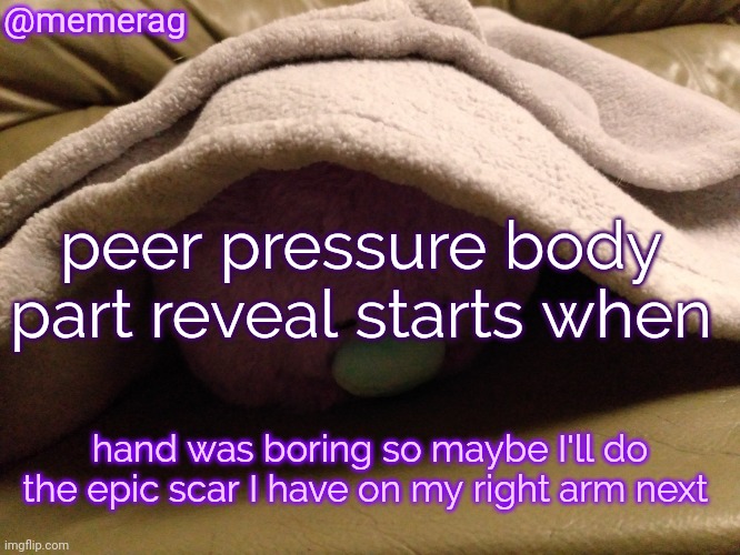 Memerag Moley B Announcement Template | @memerag; peer pressure body part reveal starts when; hand was boring so maybe I'll do the epic scar I have on my right arm next | image tagged in memerag moley b announcement template | made w/ Imgflip meme maker