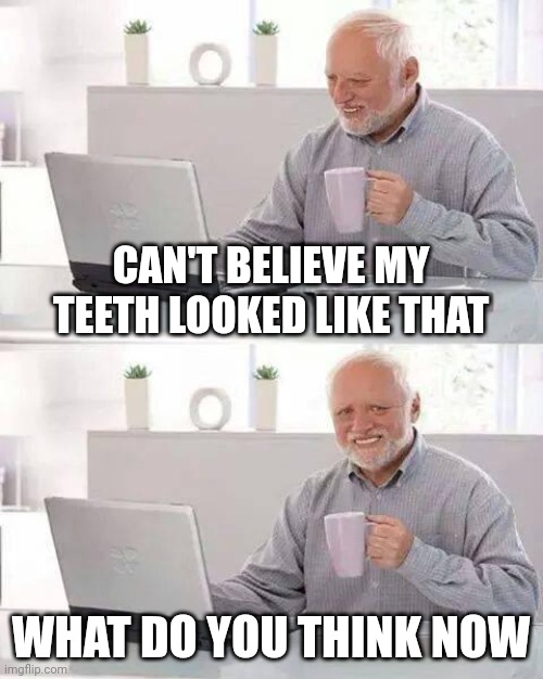 And now the fun begins | CAN'T BELIEVE MY TEETH LOOKED LIKE THAT; WHAT DO YOU THINK NOW | image tagged in memes,hide the pain harold | made w/ Imgflip meme maker