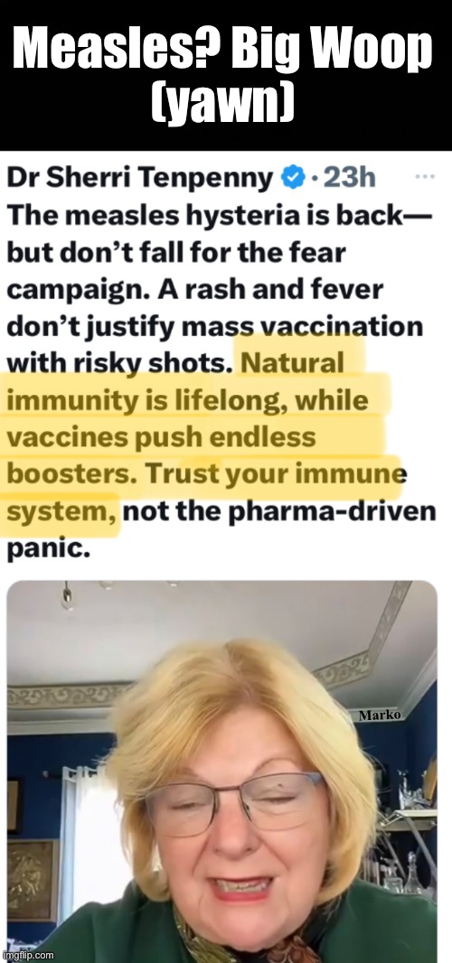 We used to have parties, so all the kids could get it at the same time | Measles? Big Woop
(yawn); Marko | image tagged in memes,measles,they wanna shoot u cuz a rash,your needles r a direct threat,all vaccines r poison,fjb voters kissmyass | made w/ Imgflip meme maker