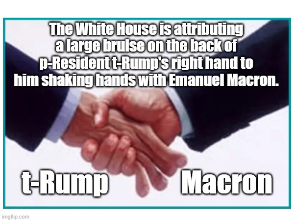 A bone crushing defeat! | The White House is attributing a large bruise on the back of p-Resident t-Rump's right hand to him shaking hands with Emanuel Macron. t-Rump              Macron | image tagged in trump,maga,red hat,french toast,tiny hands,spray tan | made w/ Imgflip meme maker