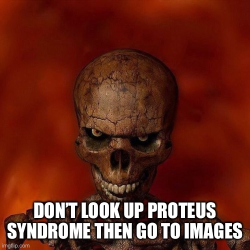 "Do not" skeleton template | DON’T LOOK UP PROTEUS SYNDROME THEN GO TO IMAGES | image tagged in do not skeleton template | made w/ Imgflip meme maker
