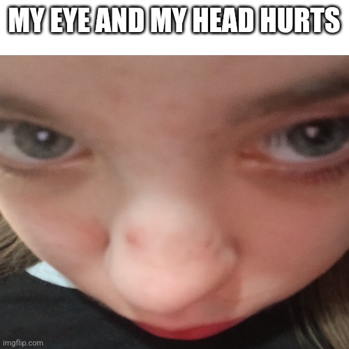 Meow | MY EYE AND MY HEAD HURTS | image tagged in oh wow are you actually reading these tags | made w/ Imgflip meme maker