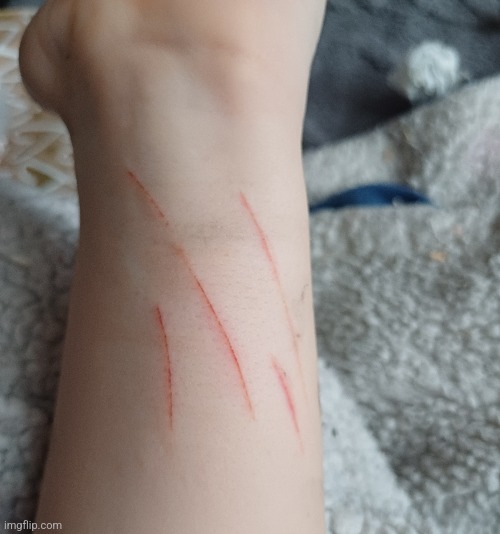 Guess who relapsed back into SH again | image tagged in self harm,help lol | made w/ Imgflip meme maker