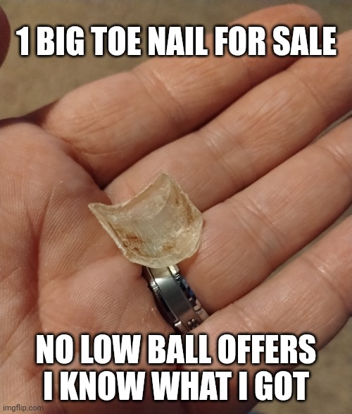 So I crushed my big toe 2 weeks ago... | 1 BIG TOE NAIL FOR SALE; NO LOW BALL OFFERS I KNOW WHAT I GOT | image tagged in toes,nails,crush | made w/ Imgflip meme maker