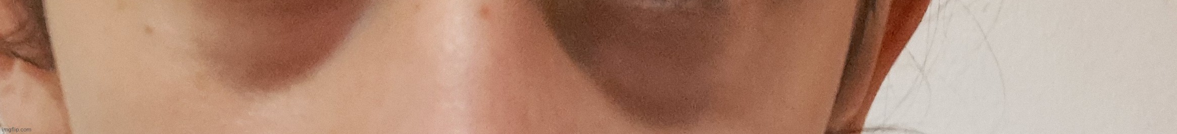 Uhm are these eyebags or lack of vitamins | made w/ Imgflip meme maker