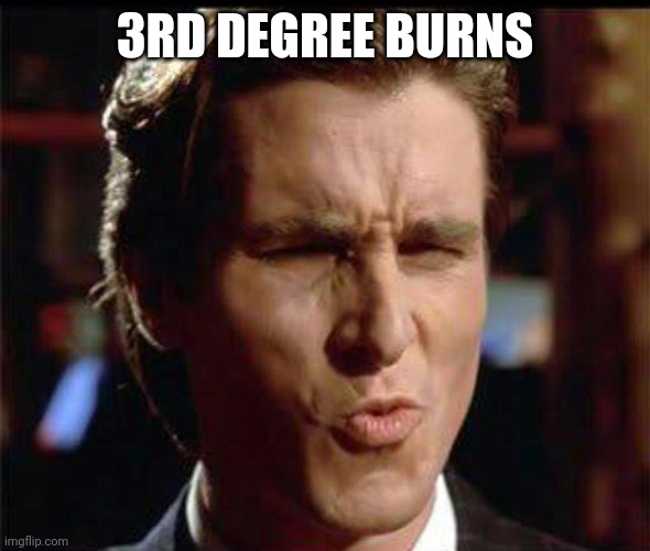 Christian Bale Ooh | 3RD DEGREE BURNS | image tagged in christian bale ooh | made w/ Imgflip meme maker