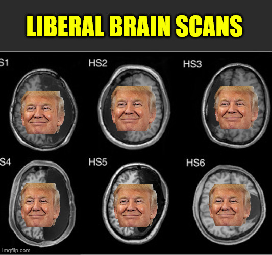 Liberal brain scans | LIBERAL BRAIN SCANS | image tagged in liberal brain scans | made w/ Imgflip meme maker