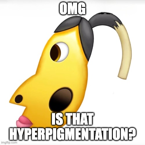 is that hyperpigmentation? | OMG; IS THAT HYPERPIGMENTATION? | image tagged in is that hyperpigmentation | made w/ Imgflip meme maker