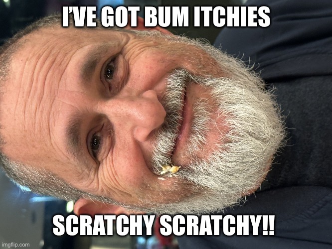 TonyWithaT | I’VE GOT BUM ITCHIES; SCRATCHY SCRATCHY!! | image tagged in tonywithat | made w/ Imgflip meme maker