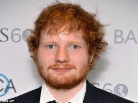 Derpy Ed Sheeran | image tagged in derpy ed sheeran | made w/ Imgflip meme maker