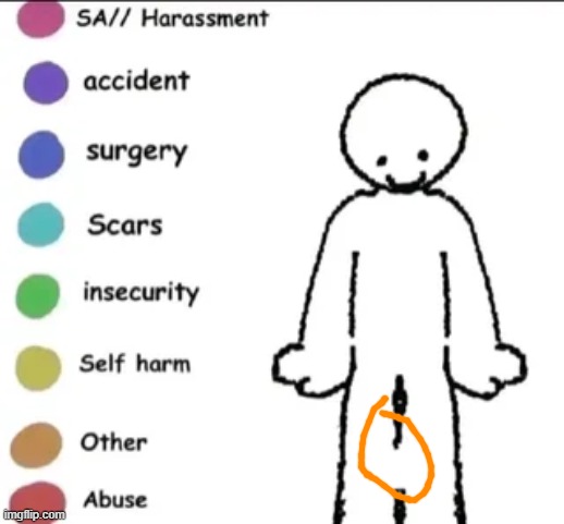 conjoined legs | image tagged in share you story | made w/ Imgflip meme maker