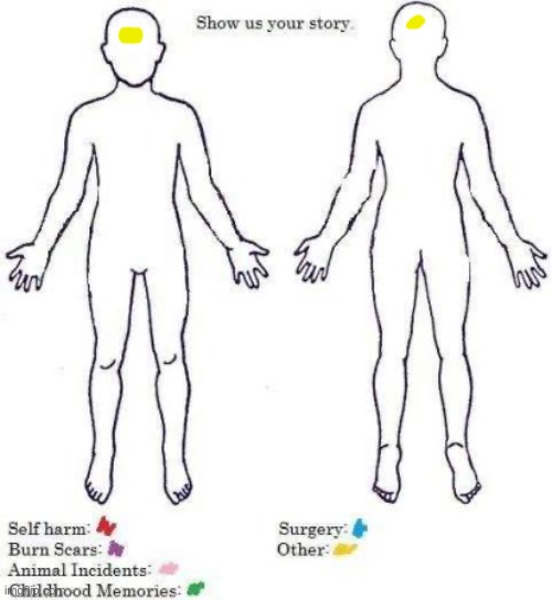 I got lobotomized last week | image tagged in show us your story | made w/ Imgflip meme maker