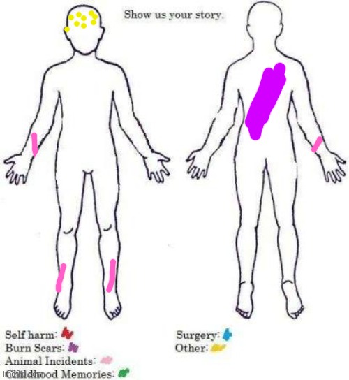 The yellow dots represent my face, idk what's wrong with my face I can't get those things away, also gm chat :3 | image tagged in show us your story | made w/ Imgflip meme maker