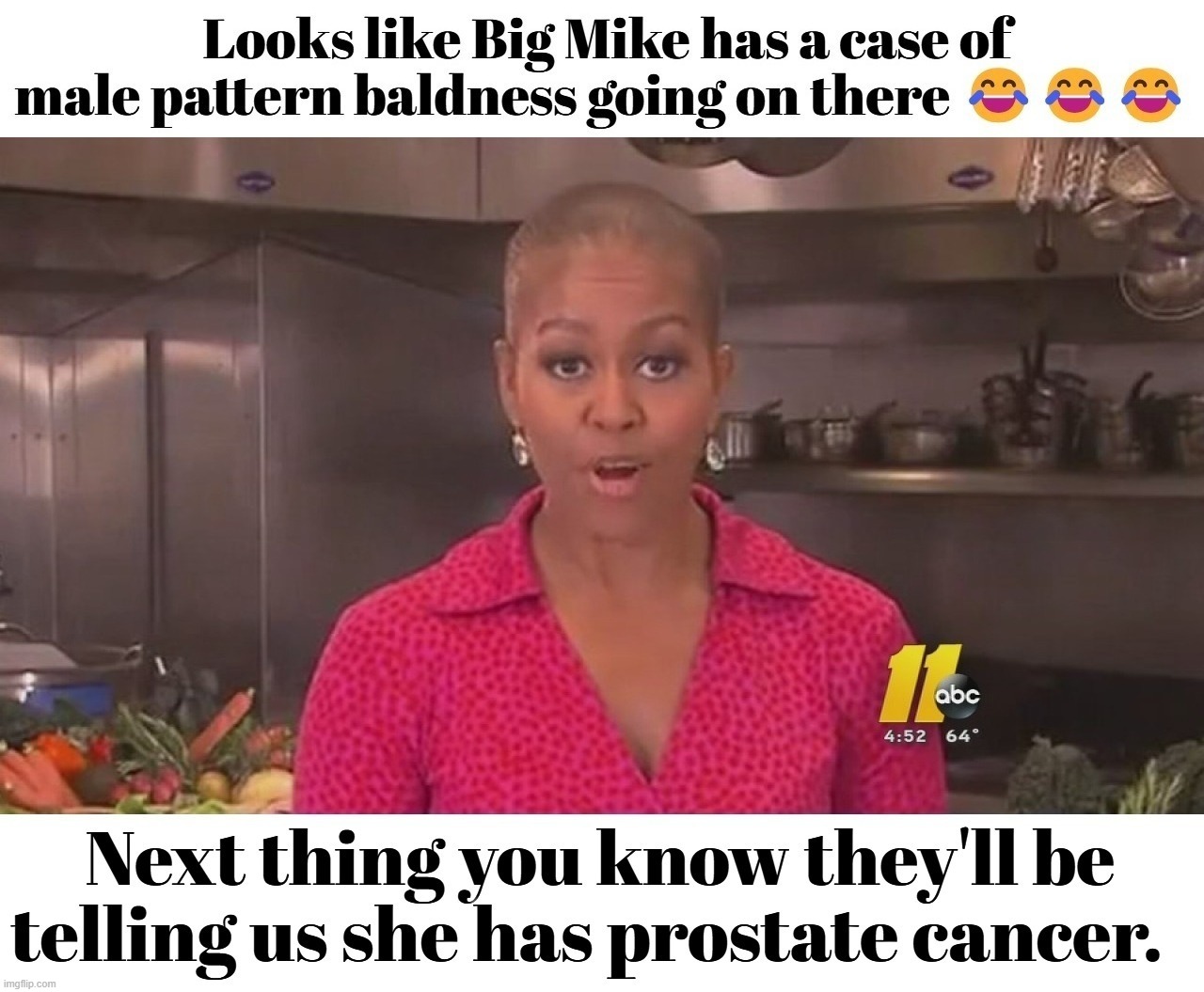 Is Big Mike going bald? | image tagged in moochelle,male pattern baldness,bald eagle,prostate exam,michelle obama,tired of hearing about transgenders | made w/ Imgflip meme maker
