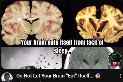 brain Blank Meme Template
