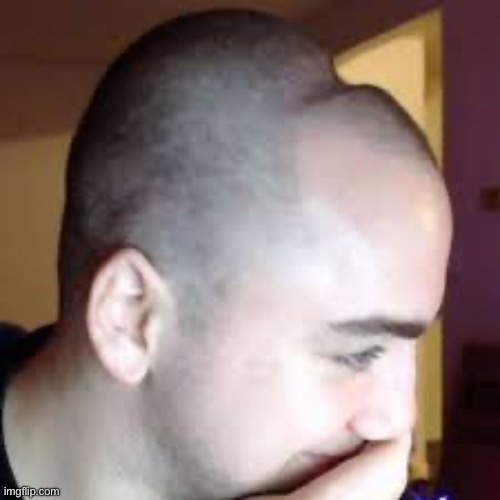 gamer dent head | image tagged in gamer dent head | made w/ Imgflip meme maker