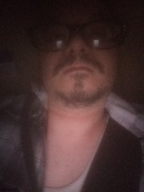 Dunno if you can see it, but wearing necklaces has rubbed raw, scaly marks in my throat. AND THEY HURT. | made w/ Imgflip meme maker