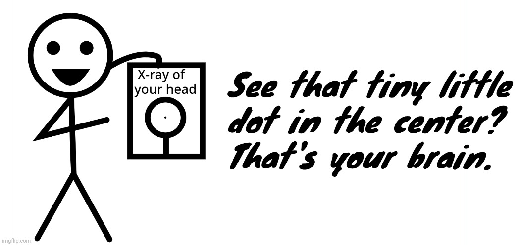 Your brain is small | image tagged in your brain is small | made w/ Imgflip meme maker