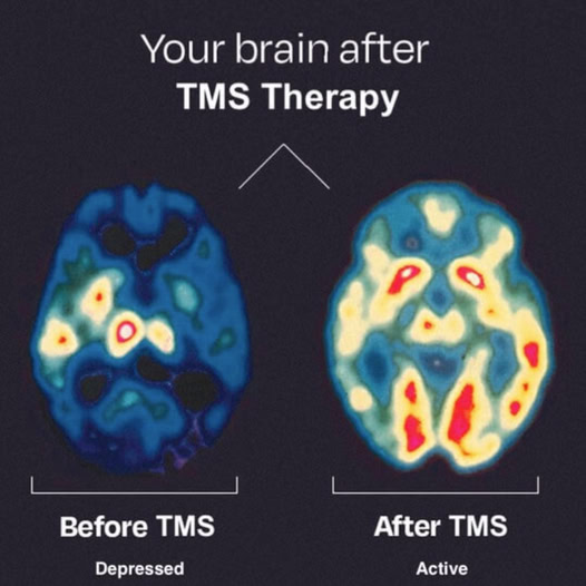 Could this be the Cure for TDS? Blank Meme Template