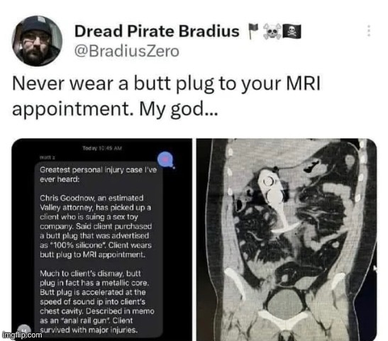 MRI | made w/ Imgflip meme maker