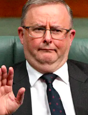 Anthony Albanese Blank Meme Template