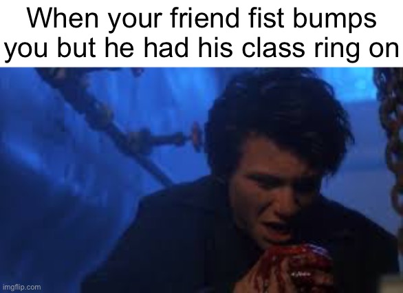 Brass knuckles right there | When your friend fist bumps you but he had his class ring on | image tagged in j d loses a finger | made w/ Imgflip meme maker