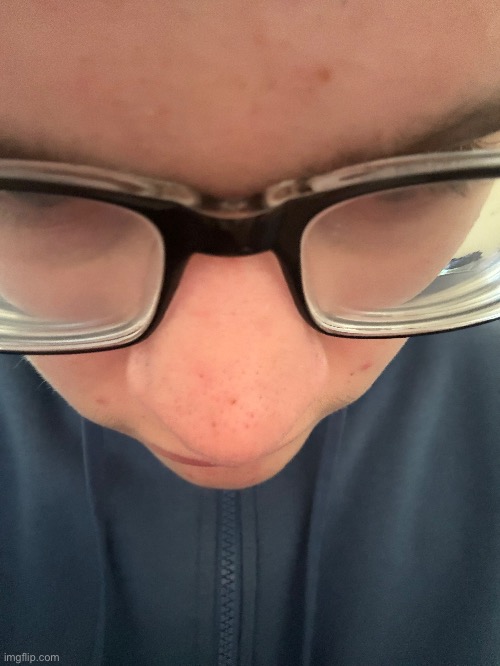 face reveal but fr this time (told you I have terrible acne) | made w/ Imgflip meme maker